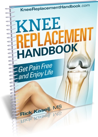 Knee Replacement Handbook